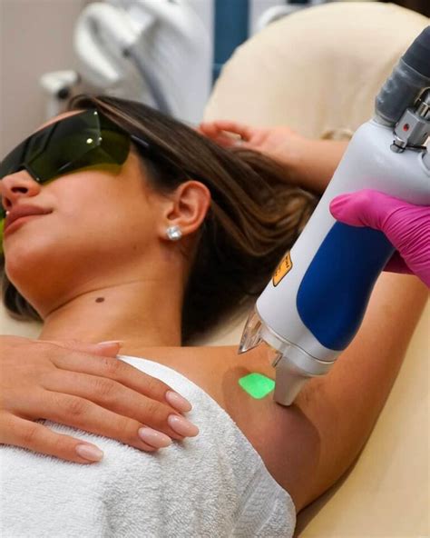 Laser Hair Removal