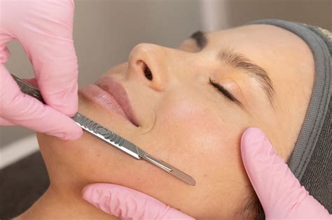 Peels and Dermaplaning treatment photo