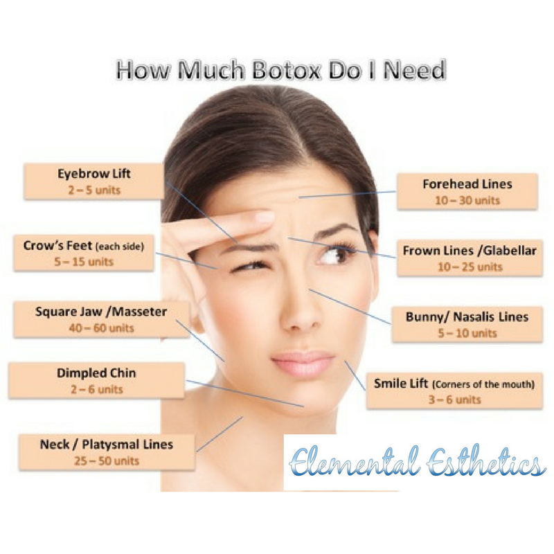 How much botox do i need