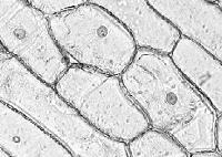 Skin cells under microscope